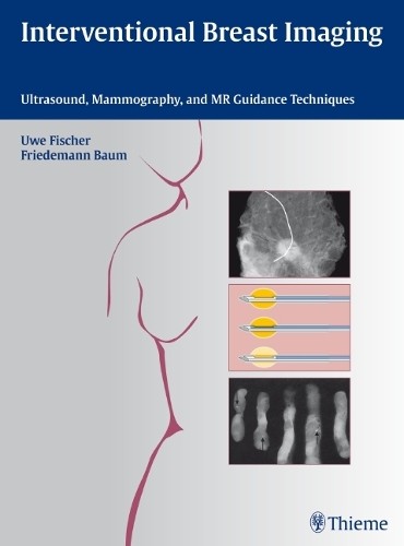 Interventional breast imaging - breast,