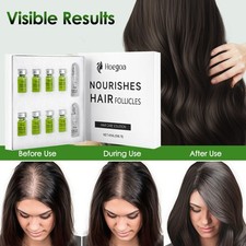 8 Pezzi Crescita Capelli Micro