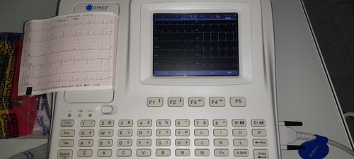 Elettrocardiografo con - elettrocardiografo,
