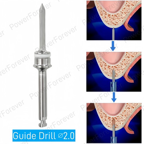 Trapano guida dentale - , ∅2.0