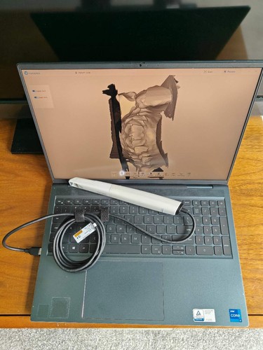 Scanner dentale intraorale - dentale,