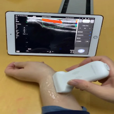 Sonda ultrasuoni lineare 128 elementi con wifi wireless e USB IOS Adroid Windows