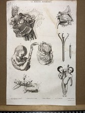 Incisione in acciaio antiquario 1834 anatomia medicina chirurgia medico...