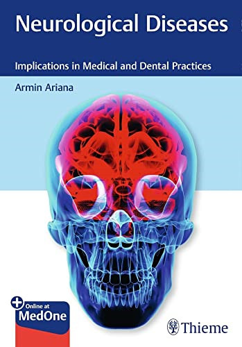 Neurological diseases - neurological,