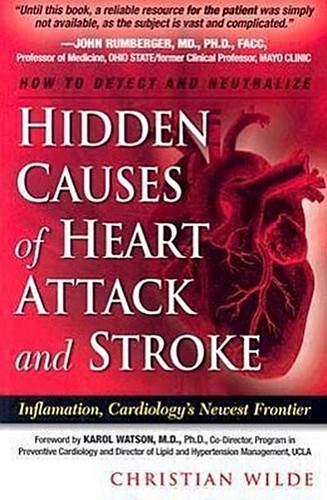 Hidden causes heart attack - causes,