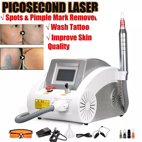 Laser yag rimozione - laser, nd