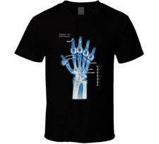 Kobe Bryant Hand X Ray Rings