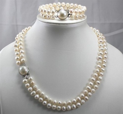 Bellissimo set bracciale