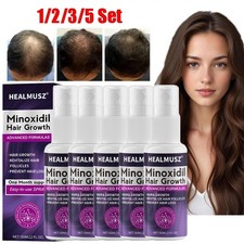 Minoxidil 2% Trattamento
