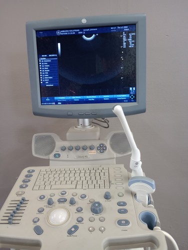 Logiq ultrasound plus 2 - plus,
