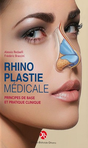 Rhinoplastie médicale