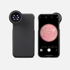XMSJ Dermatoscopio Elettronico
