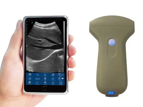 Macchina scanner ultrasuoni