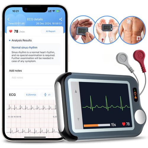 Monitor ecg domestico - con, cavo