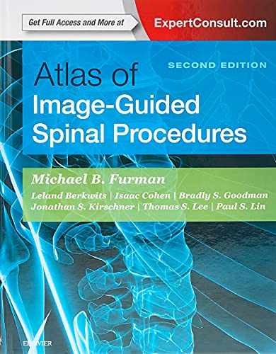Atlas image guided - atlas, of