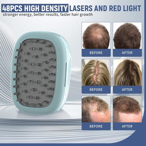 Pettine crescita capelli - , laser