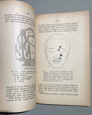 MEDICINA-OTORINOLARINGOIATRIA-NASO-FARINGE-LARINGE-OTITI-FARINGITI-SANVENERO-'30