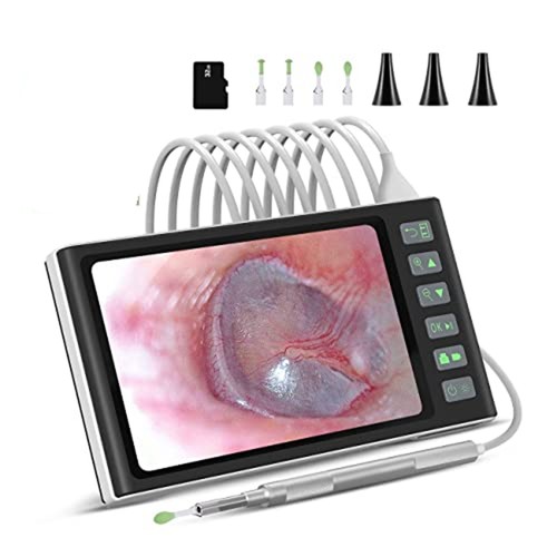 Otoscopio digitale con schermo - con,