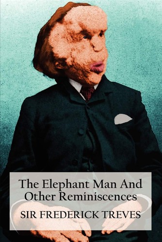 The elephant man and - the,