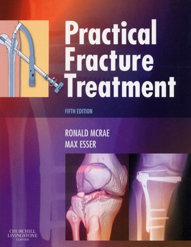 Practical fracture treatment - practical,