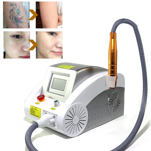 Rimozione pigmenti tatuaggi - rimozione,