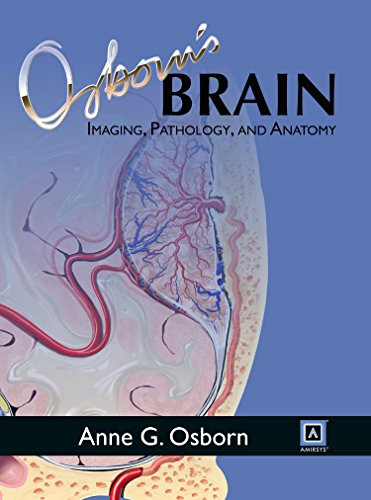 Osborn brain imaging - osborn's,
