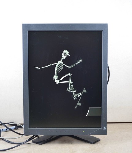 Eizo radiforce rx240 - eizo, 21,3