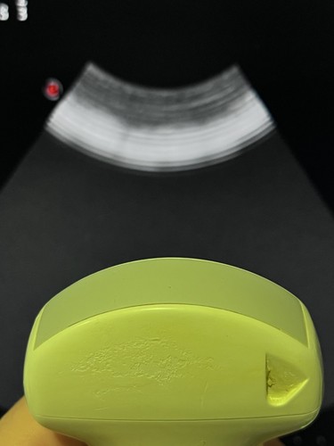 Esaote probe ca431 - esaote,