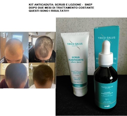 Kit anticaduta scrub - kit, anticaduta: