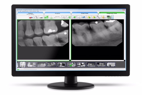 Evasoft dental imaging - dental,