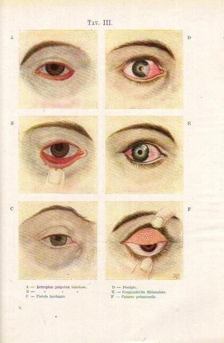 MEDICINA_OCULISTICA_OCCHIO_PAT