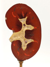 MODELLO ANATOMICO ANNI '30 - RENE SU BASE DI LEGNO ( 2 )