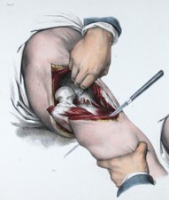 1866,ANATOMIA UMANA N.H. JACOB COLORE MANO XAH