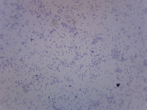 Clostridium botulinum - clostridium,