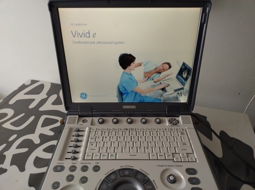 Ecocardiografo portatile - ecocardiografo,