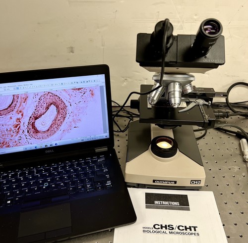 Olympus ch2 chs cht - ch2, patologia