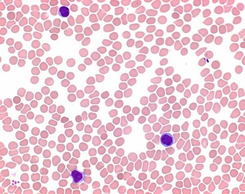 Eosina soluzione blu - , di