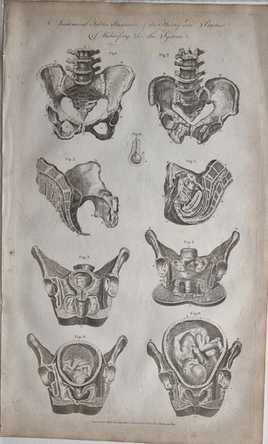 C1795 antico stampa anatomia - c1795,
