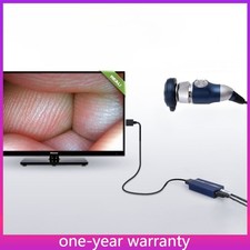 Telecamera endoscopio