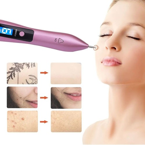 Penna plasma laser 9 - al,