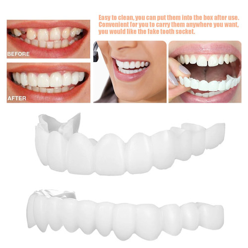 Smile snap set copri denti - on,