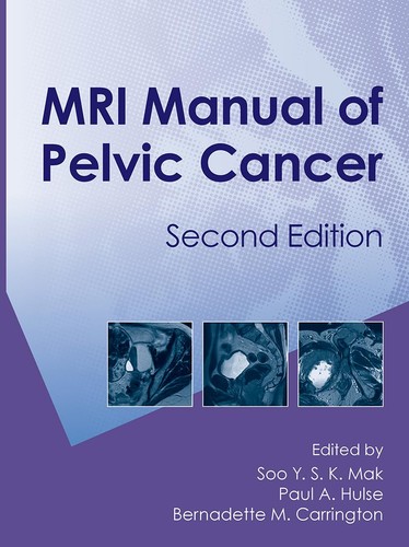 Mri manual pelvic - pelvic, cancer