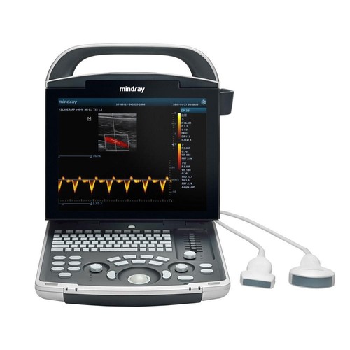 Mindray power color - dp-30,