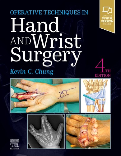 Operative techniques hand and - techniques:,