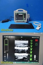 Sistema ecografico portatile