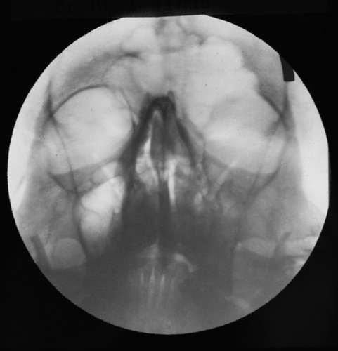 Magic lantern slide xray - slide,
