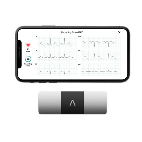 Kardiamobile ecg livello - ecg,
