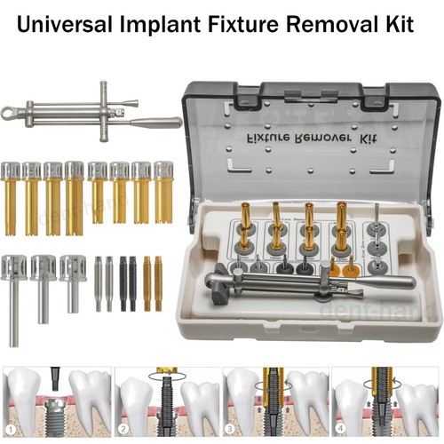 Neobiotech style kit - fr,