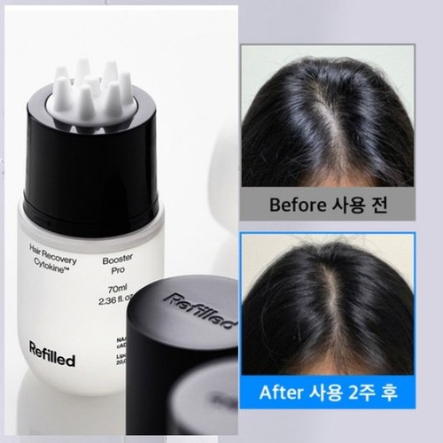 Refilled hair recovery - hair,