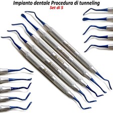 Vista procedura di tunneling